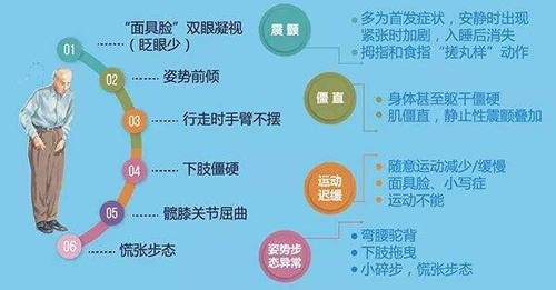 帕金森病的常识及奧博帕金森治疗仪的特点