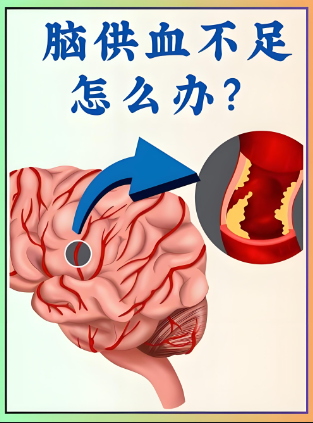 脑供血不足脑功能康复治疗仪_脑供血不足的表现 