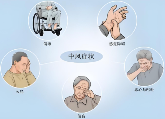 奥博脑功能康复治疗仪对中风效果_中风有哪些后遗症呢