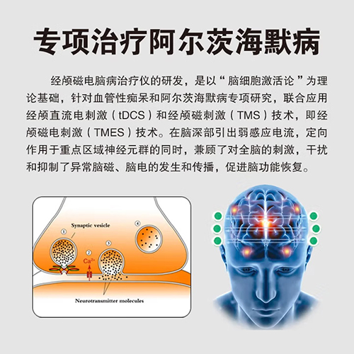 奥博阿尔茨海默治疗仪原理
