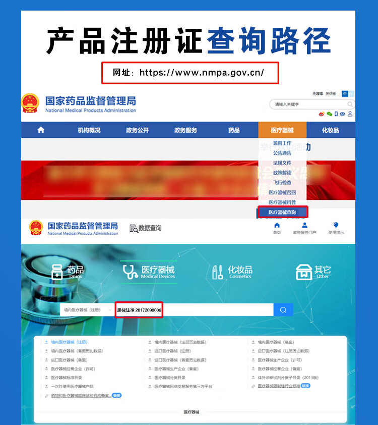 脑功能康复治疗仪 