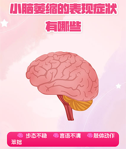 脑萎缩治疗仪器有用吗_小脑萎缩走路不稳能治好吗