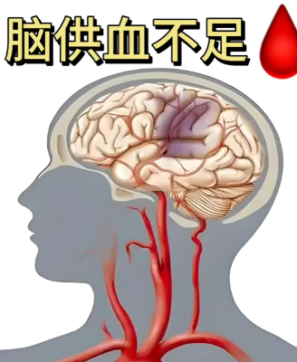 经颅电脑功能康复治疗仪功效_脑供血不足头晕怎么缓解