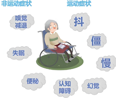 治疗帕金森的机器_帕金森综合症是什么步态