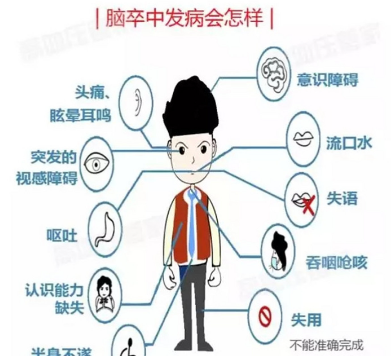 脑卒中物理治疗仪器奥博甄选_脑卒中是个什么病