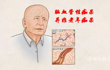 痴呆症辅助仪器奥博甄选_血管性痴呆怎么治疗