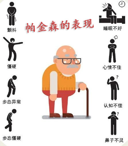 奥博甄选_帕金森出现强直是什么原因引起的