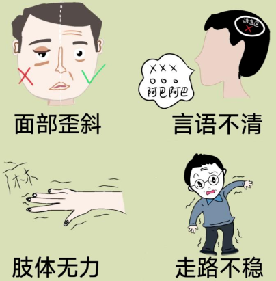 孙作东奥博家用治疗仪_短暂性脑缺血有哪些并发症呢