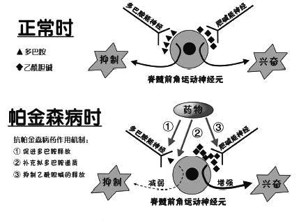 奥博家用帕金森治疗仪_帕金森综合征是由什么导致的 
