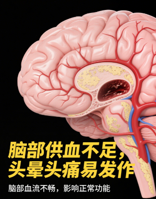 南京奥博脑供血不足治疗仪器_脑供血不足还能恢复