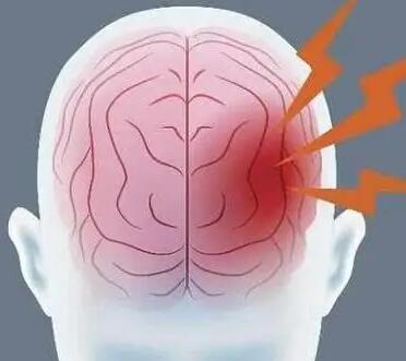 奥博治疗仪脑出血后遗症治疗仪器_脑出血多长时间能恢复正常 