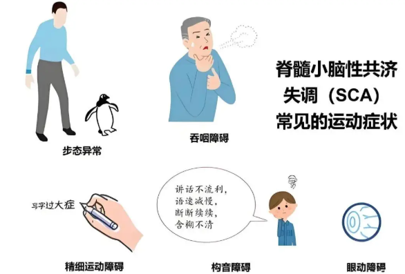 南京奥博辅助康复手段_共济失调小脑萎缩能恢复吗