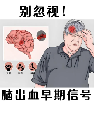 脑溢血治疗仪器品牌_科学护理脑溢血，助力肢体功能恢复 