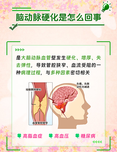 奥博甄选正规仪器_合理调养改善脑动脉硬化状况