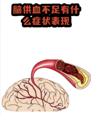 奥博甄选家庭康复_调理脑供血不足远离头晕脑胀困扰