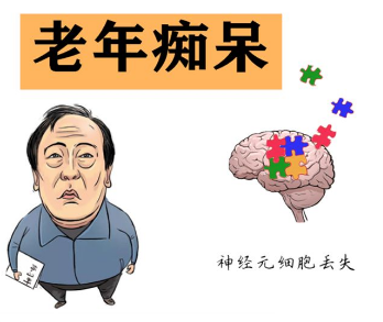 阿尔兹海默症辅助器具_阿尔茨海默症影响寿命吗?