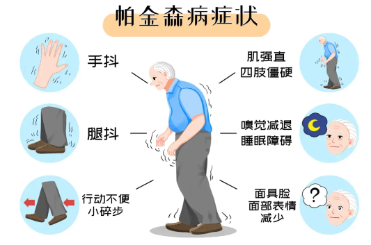 经颅磁电脑部刺激仪南京奥博_帕金森综合症有遗传性吗?