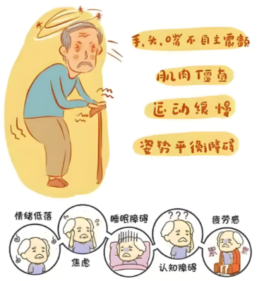 奥博治疗仪无创物理治疗_帕金森走路能恢复吗?