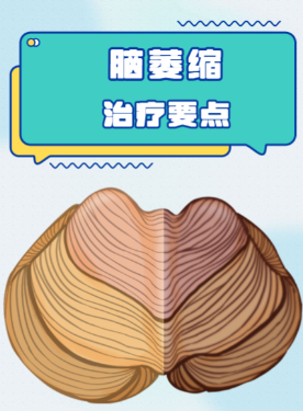奥博家用治疗仪家庭康复手段_小脑萎缩最终会怎样?