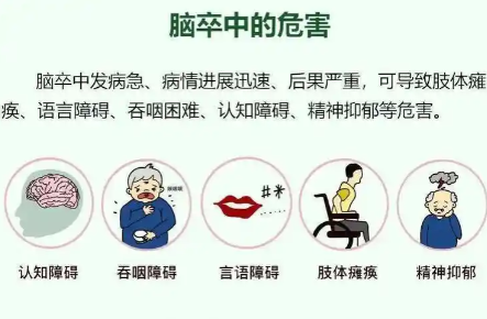 奥博甄选辅助治疗手段_小卒中最明显三个症状 