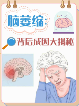 奥博治疗仪康复辅助工具_脑萎缩人群占多少?