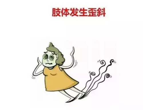 脑血栓治疗方案_脑血栓病人脑袋出现异常了吗?